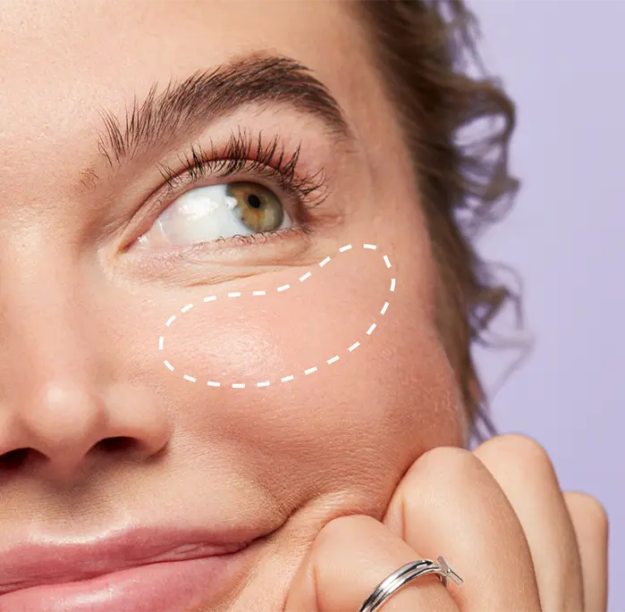 Close up of a woman leaning her chin on her hand with a dotted line circle under her eye
