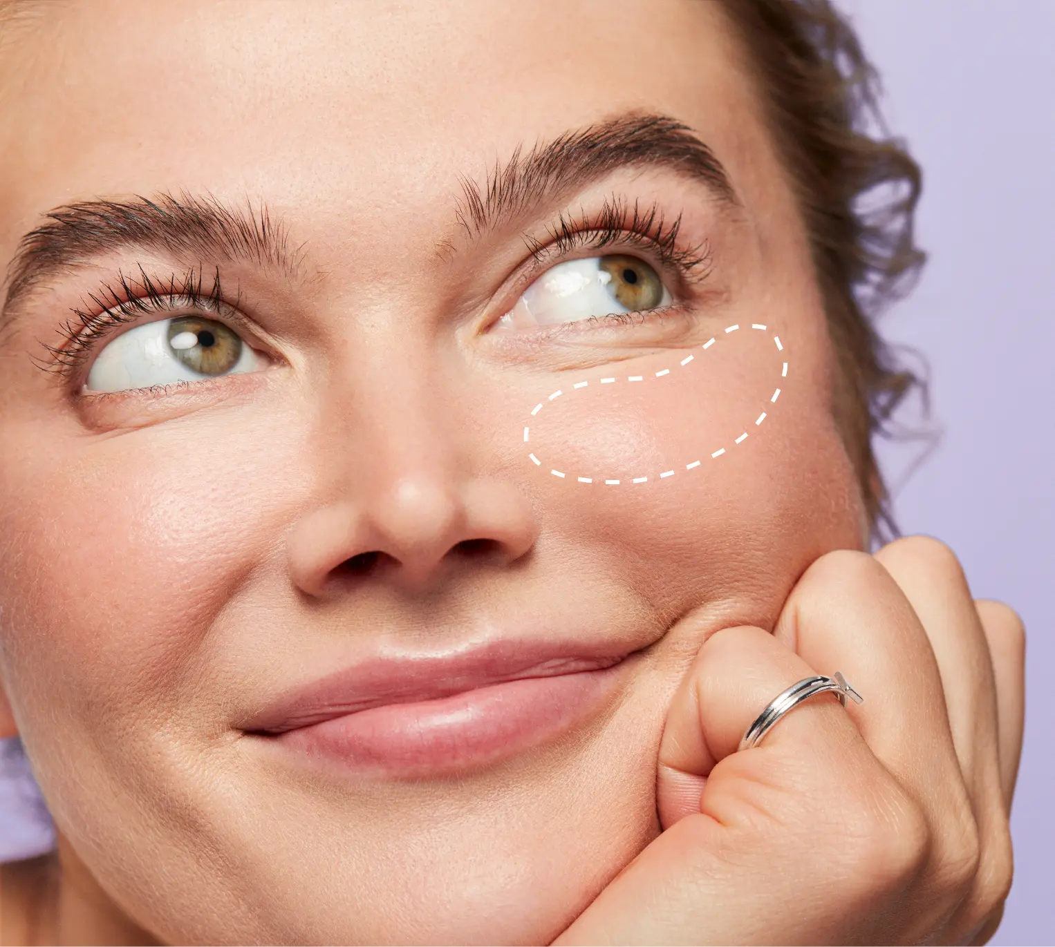 Close up of a woman leaning her chin on her hand with a dotted line circle under her eye