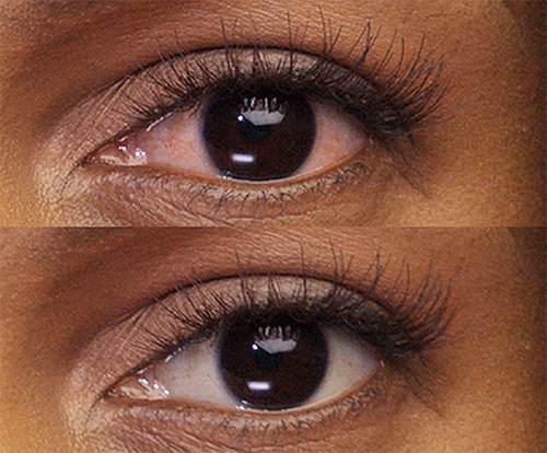 Before and after shot of an eye after using Lumify eye drops